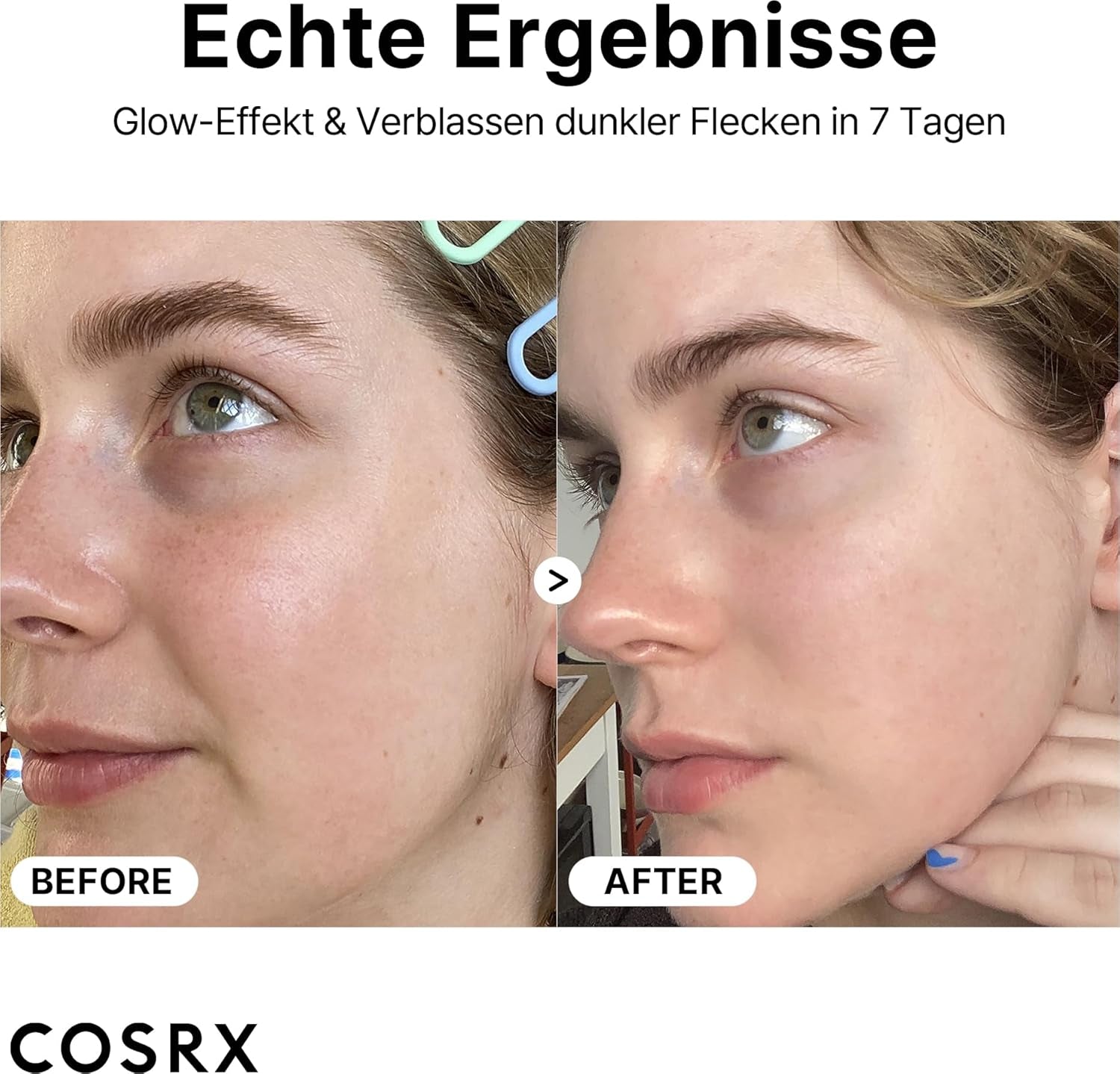 Sérum À La Vitamine C Pure À 23% Avec Vitamine E (Acide Ascorbique) Et Acide Hyaluronique, Sérum Hydratant Pour Le Visage, Réduit Les Ridules 0,70 Fl.Oz, 20 G (Paquet De 1)